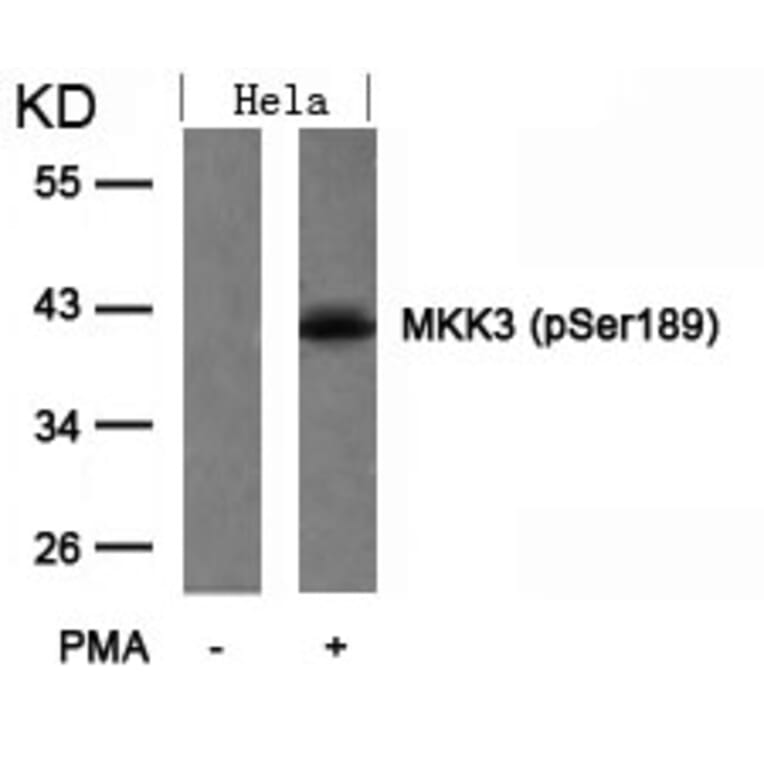 Western blot - MKK3 (Phospho-Ser189) Antibody from Signalway Antibody (11145) - Antibodies.com