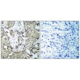 Immunohistochemistry - MKK3 (Phospho-Ser189) Antibody from Signalway Antibody (11145) - Antibodies.com