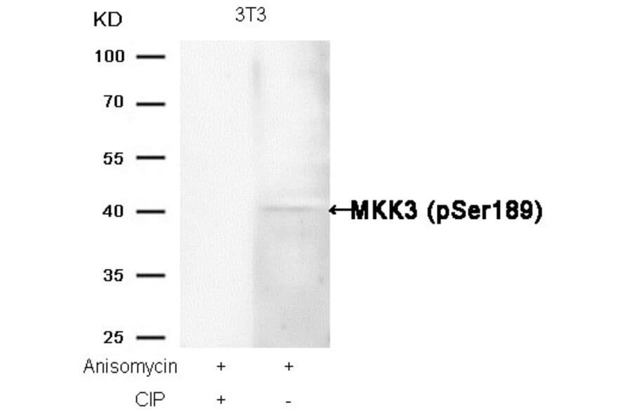 Western blot - MKK3 (Phospho-Ser189) Antibody from Signalway Antibody (11145) - Antibodies.com