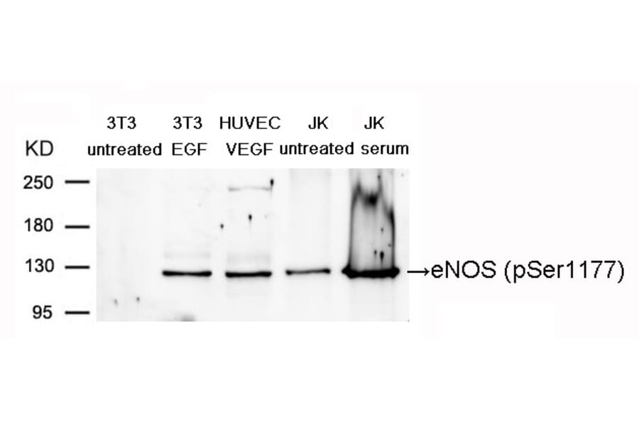 Western blot - eNOS (Phospho-Ser1177) Antibody from Signalway Antibody (11156) - Antibodies.com