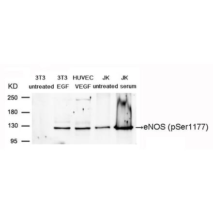 Western blot - eNOS (Phospho-Ser1177) Antibody from Signalway Antibody (11156) - Antibodies.com
