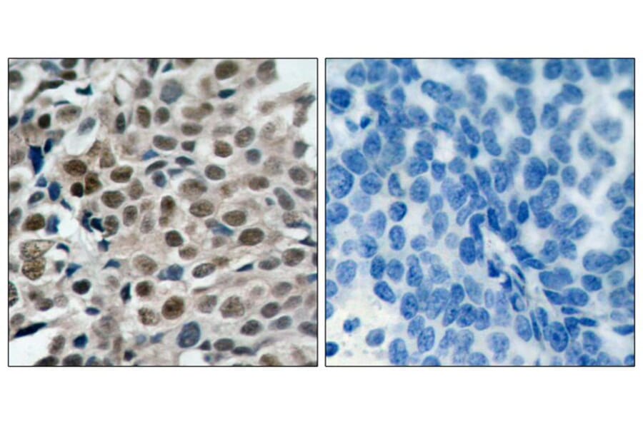 Immunohistochemistry - FKHRL1 (Phospho-Ser253) Antibody from Signalway Antibody (11157) - Antibodies.com