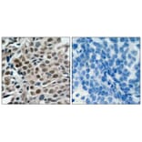 Immunohistochemistry - FKHRL1 (Phospho-Ser253) Antibody from Signalway Antibody (11157) - Antibodies.com