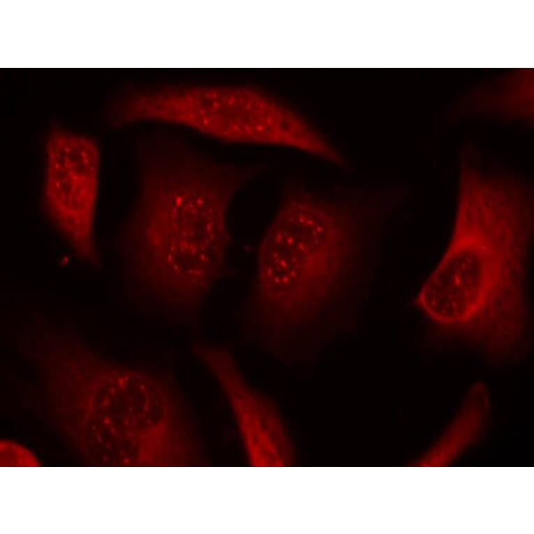 Immunofluorescence - FKHRL1 (Phospho-Ser253) Antibody from Signalway Antibody (11157) - Antibodies.com