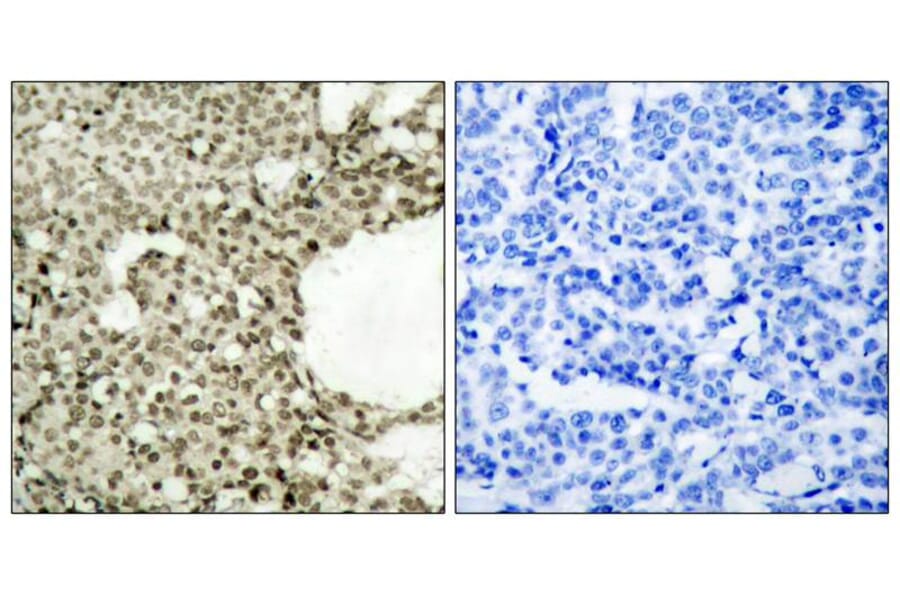 Immunohistochemistry - STAT1 (Phospho-Ser727) Antibody from Signalway Antibody (11163) - Antibodies.com
