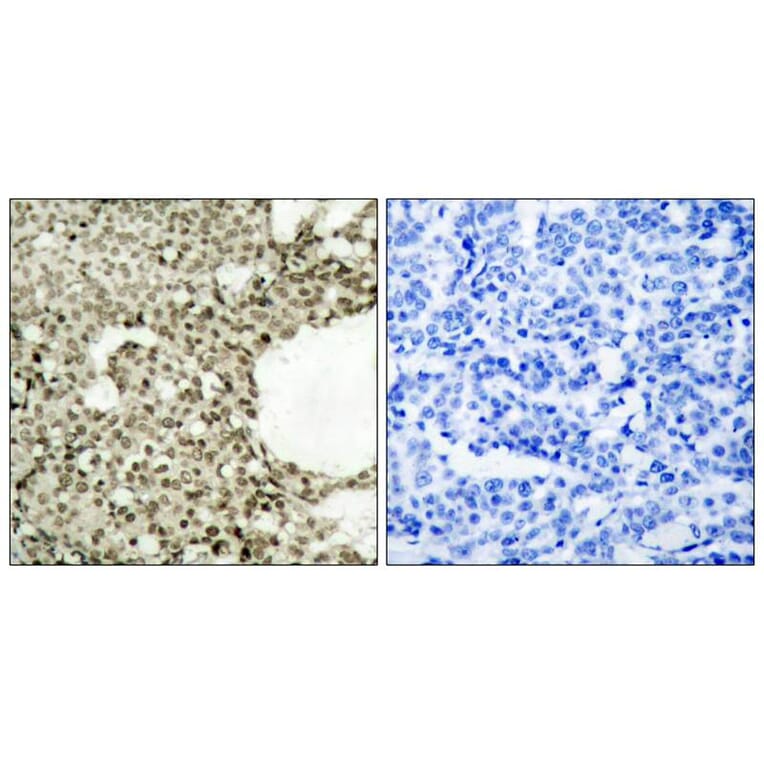 Immunohistochemistry - STAT1 (Phospho-Ser727) Antibody from Signalway Antibody (11163) - Antibodies.com
