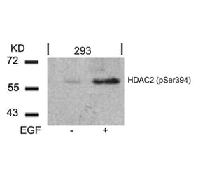 Western blot - HDAC2 (Phospho-Ser394) Antibody from Signalway Antibody (11191) - Antibodies.com