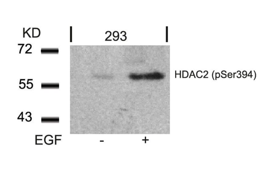 Western blot - HDAC2 (Phospho-Ser394) Antibody from Signalway Antibody (11191) - Antibodies.com