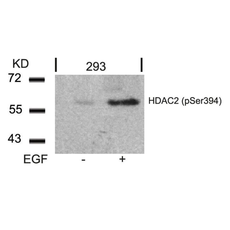 Western blot - HDAC2 (Phospho-Ser394) Antibody from Signalway Antibody (11191) - Antibodies.com