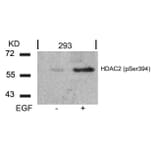 Western blot - HDAC2 (Phospho-Ser394) Antibody from Signalway Antibody (11191) - Antibodies.com