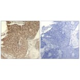 Immunohistochemistry - HDAC2 (Phospho-Ser394) Antibody from Signalway Antibody (11191) - Antibodies.com