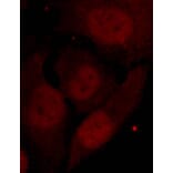 Immunofluorescence - HDAC2 (Phospho-Ser394) Antibody from Signalway Antibody (11191) - Antibodies.com