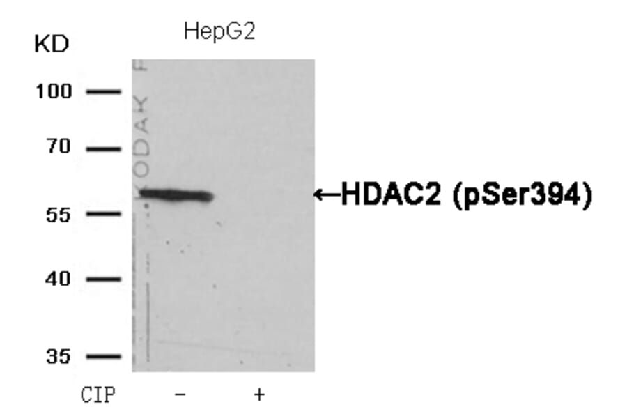 Western blot - HDAC2 (Phospho-Ser394) Antibody from Signalway Antibody (11191) - Antibodies.com