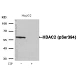 Western blot - HDAC2 (Phospho-Ser394) Antibody from Signalway Antibody (11191) - Antibodies.com