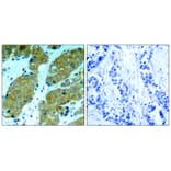Immunohistochemistry - mTOR (Phospho-Ser2448) Antibody from Signalway Antibody (11221) - Antibodies.com