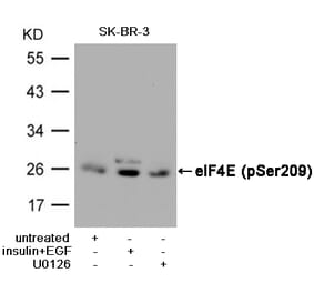 Western blot - eIF4E (Phospho-Ser209) Antibody from Signalway Antibody (11233) - Antibodies.com