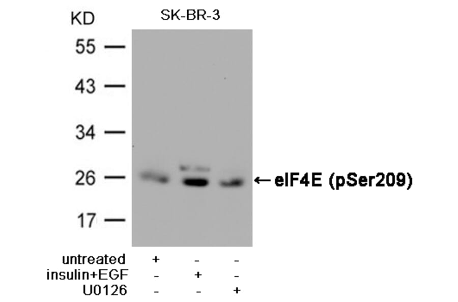 Western blot - eIF4E (Phospho-Ser209) Antibody from Signalway Antibody (11233) - Antibodies.com