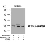 Western blot - eIF4E (Phospho-Ser209) Antibody from Signalway Antibody (11233) - Antibodies.com
