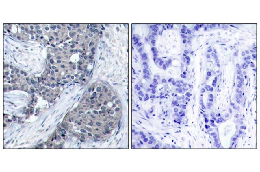 Immunohistochemistry - eIF4E (Phospho-Ser209) Antibody from Signalway Antibody (11233) - Antibodies.com