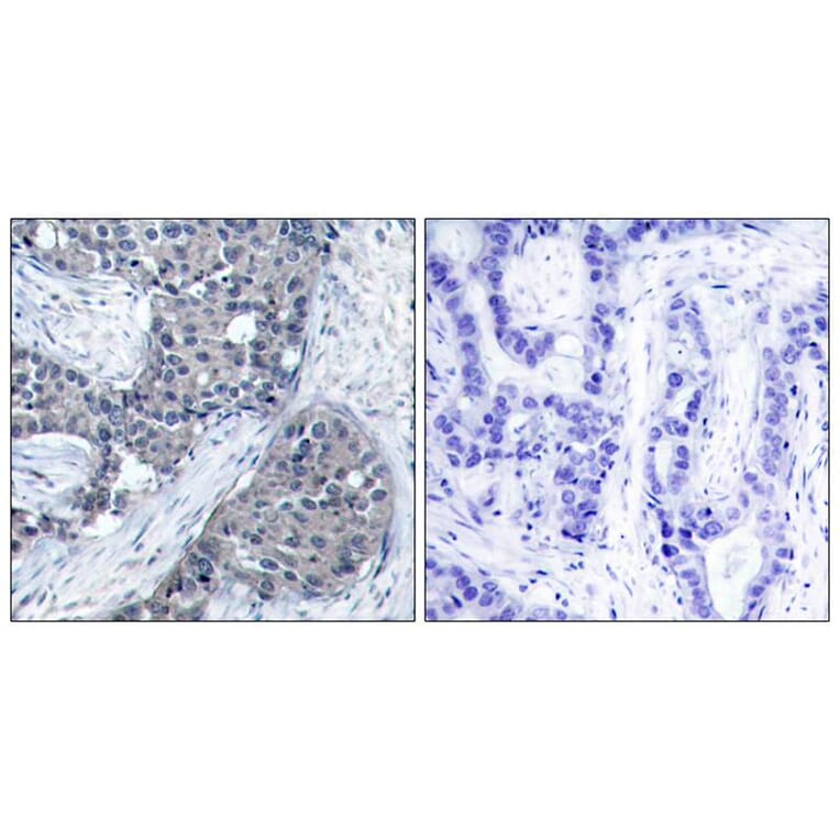 Immunohistochemistry - eIF4E (Phospho-Ser209) Antibody from Signalway Antibody (11233) - Antibodies.com
