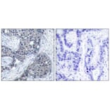 Immunohistochemistry - eIF4E (Phospho-Ser209) Antibody from Signalway Antibody (11233) - Antibodies.com