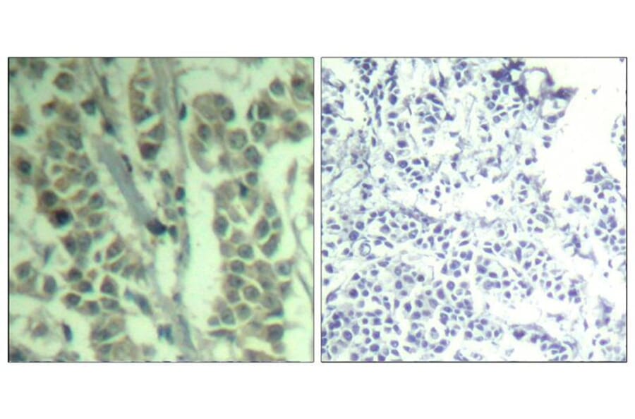 Immunohistochemistry - c-Cbl (phospho-Tyr700) Antibody from Signalway Antibody (11549) - Antibodies.com