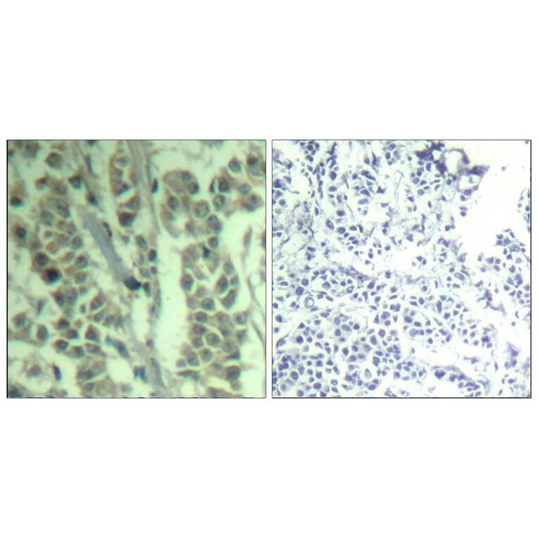 Immunohistochemistry - c-Cbl (phospho-Tyr700) Antibody from Signalway Antibody (11549) - Antibodies.com