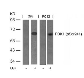 Western blot - PDK1 (Phospho-Ser241) Antibody from Signalway Antibody (11005) - Antibodies.com