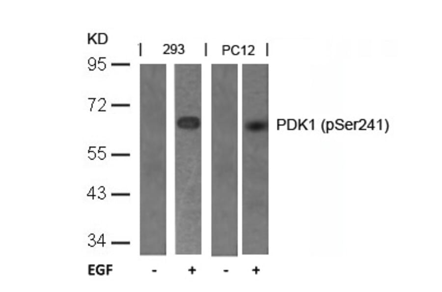 Western blot - PDK1 (Phospho-Ser241) Antibody from Signalway Antibody (11005) - Antibodies.com