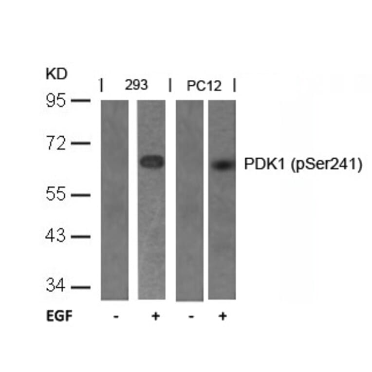 Western blot - PDK1 (Phospho-Ser241) Antibody from Signalway Antibody (11005) - Antibodies.com