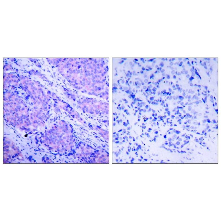 Immunohistochemistry - PDK1 (Phospho-Ser241) Antibody from Signalway Antibody (11005) - Antibodies.com