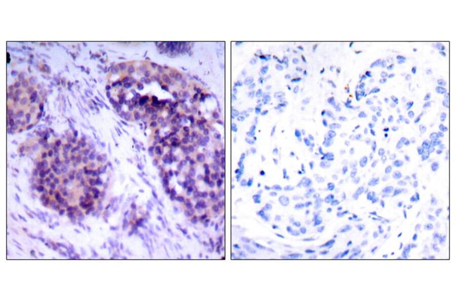Immunohistochemistry - BCL-XL (Phospho-Ser62) Antibody from Signalway Antibody (11066) - Antibodies.com