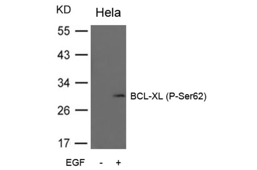 Western blot - BCL-XL (Phospho-Ser62) Antibody from Signalway Antibody (11066) - Antibodies.com