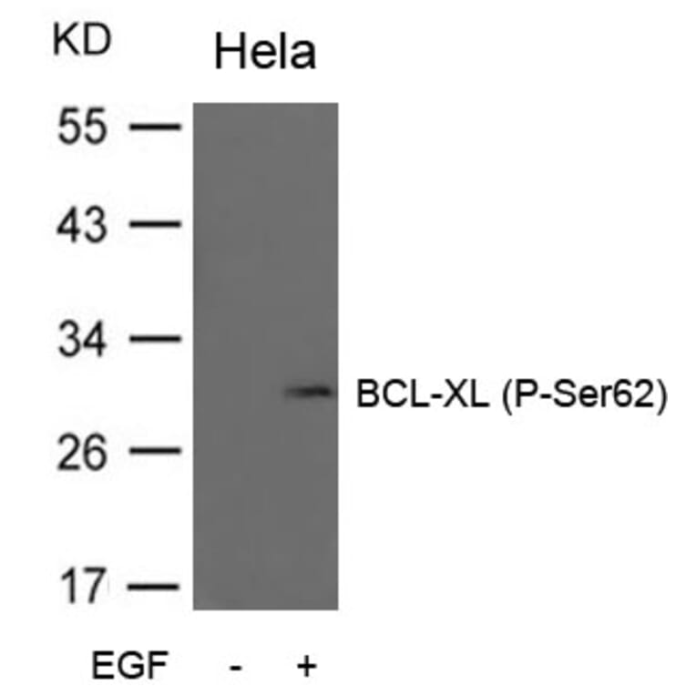 Western blot - BCL-XL (Phospho-Ser62) Antibody from Signalway Antibody (11066) - Antibodies.com