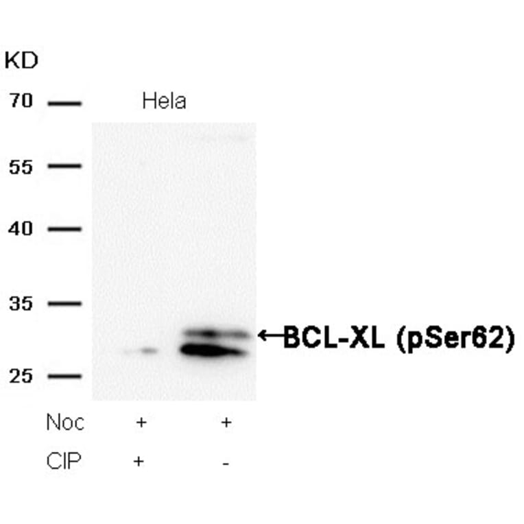 Western blot - BCL-XL (Phospho-Ser62) Antibody from Signalway Antibody (11066) - Antibodies.com