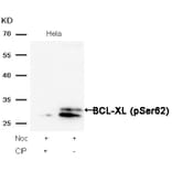 Western blot - BCL-XL (Phospho-Ser62) Antibody from Signalway Antibody (11066) - Antibodies.com