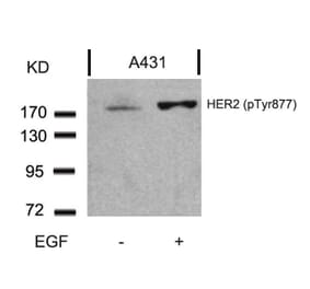 Western blot - HER2 (Phospho-Tyr877) Antibody from Signalway Antibody (11075) - Antibodies.com