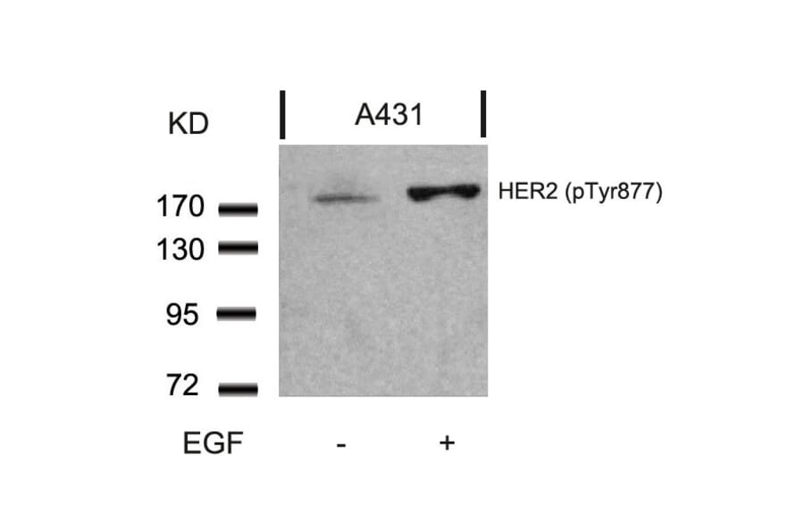 Western blot - HER2 (Phospho-Tyr877) Antibody from Signalway Antibody (11075) - Antibodies.com