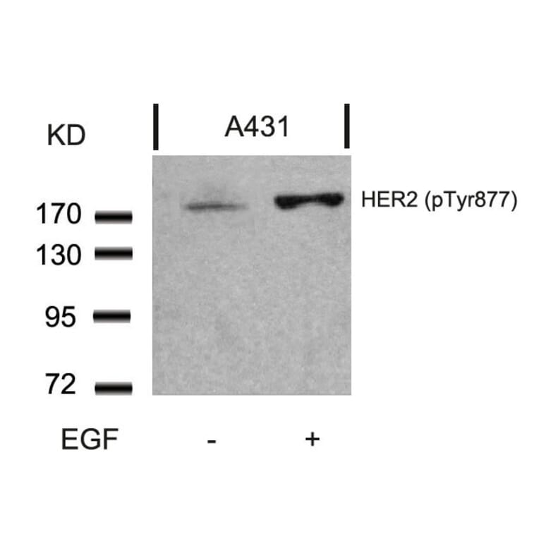 Western blot - HER2 (Phospho-Tyr877) Antibody from Signalway Antibody (11075) - Antibodies.com