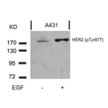 Western blot - HER2 (Phospho-Tyr877) Antibody from Signalway Antibody (11075) - Antibodies.com