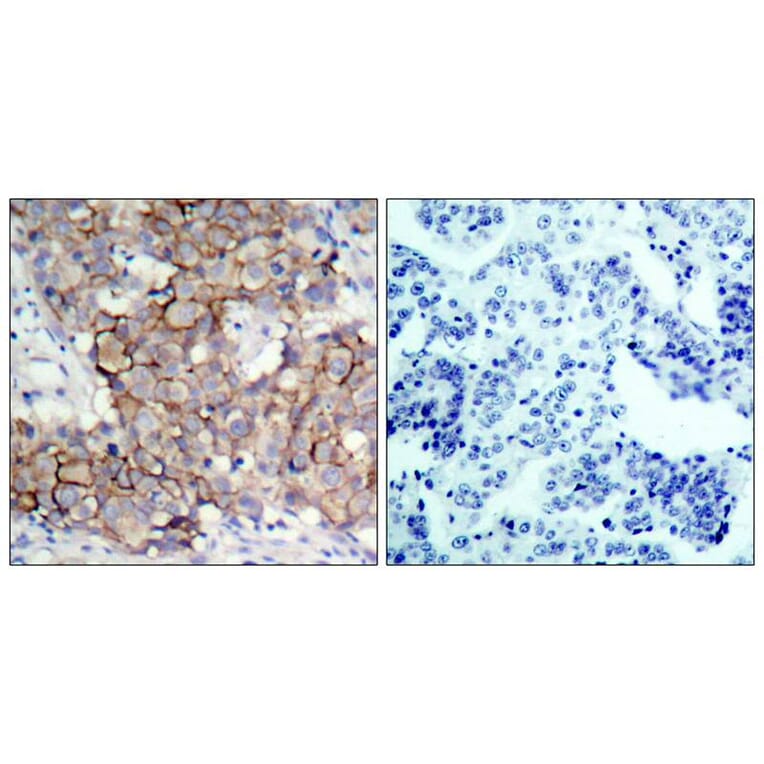Immunohistochemistry - HER2 (Phospho-Tyr877) Antibody from Signalway Antibody (11075) - Antibodies.com