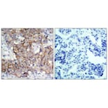 Immunohistochemistry - HER2 (Phospho-Tyr877) Antibody from Signalway Antibody (11075) - Antibodies.com