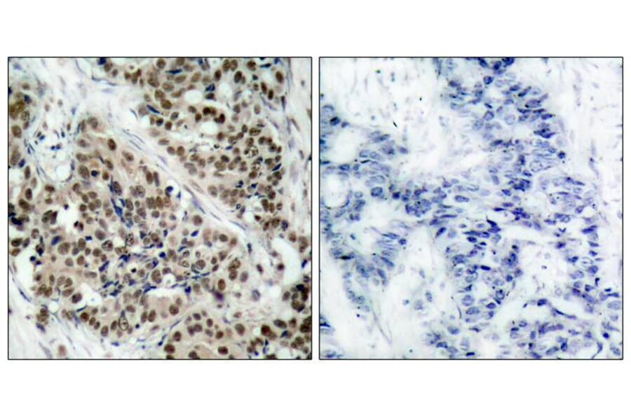 Immunohistochemistry - FKHR (Phospho-Ser256) Antibody from Signalway Antibody (11115) - Antibodies.com
