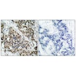 Immunohistochemistry - FKHR (Phospho-Ser256) Antibody from Signalway Antibody (11115) - Antibodies.com