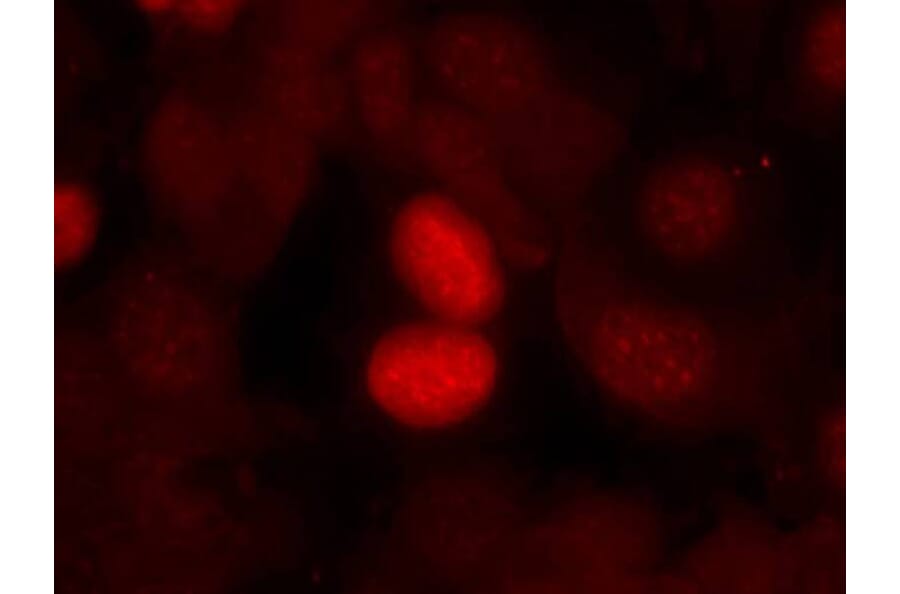 Immunofluorescence - FKHR (Phospho-Ser256) Antibody from Signalway Antibody (11115) - Antibodies.com
