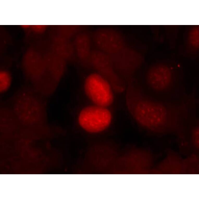 Immunofluorescence - FKHR (Phospho-Ser256) Antibody from Signalway Antibody (11115) - Antibodies.com