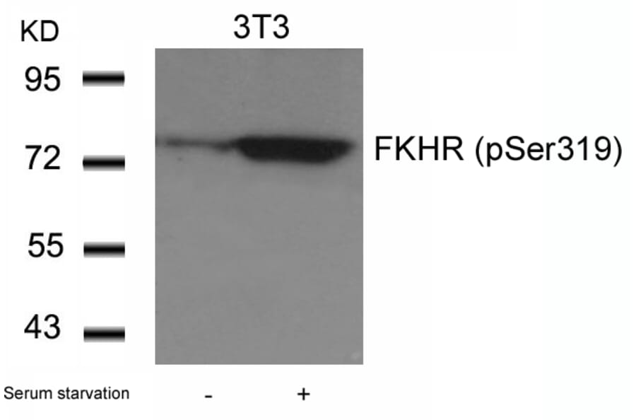 Western blot - FKHR (Phospho-Ser319) Antibody from Signalway Antibody (11136) - Antibodies.com