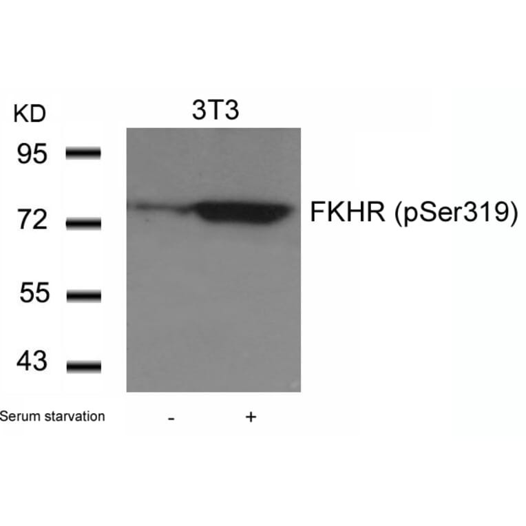 Western blot - FKHR (Phospho-Ser319) Antibody from Signalway Antibody (11136) - Antibodies.com