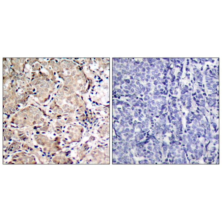 Immunohistochemistry - FKHR (Phospho-Ser319) Antibody from Signalway Antibody (11136) - Antibodies.com