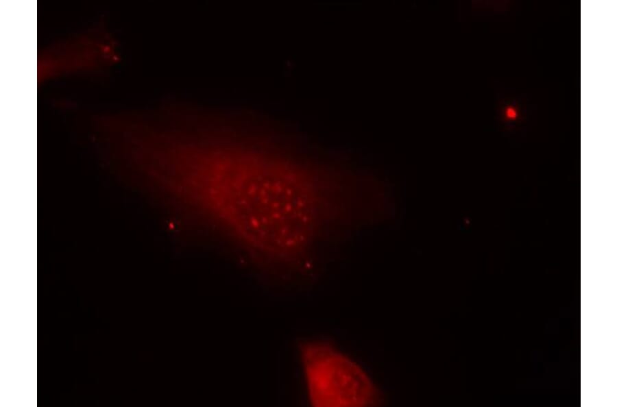 Immunofluorescence - FKHR (Phospho-Ser319) Antibody from Signalway Antibody (11136) - Antibodies.com